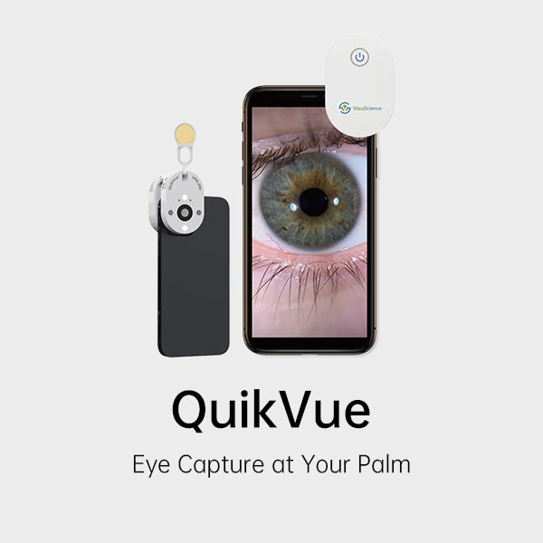 Adaptador de Imagen Ocular QuickVue Plus