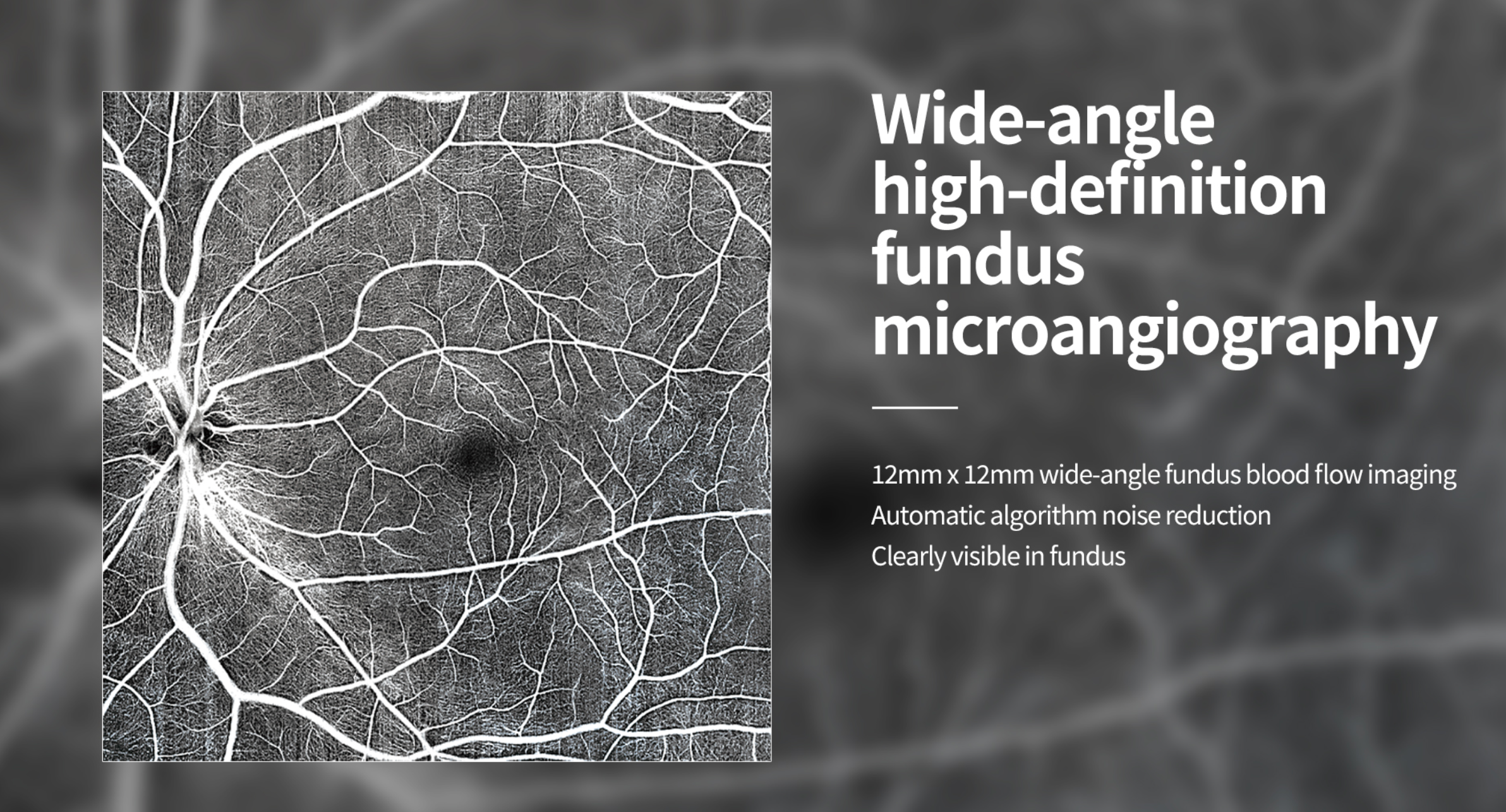 OCT Velite C-3000 OCT-ANGIO Alta Velocidad / Ultra Alta Resolución