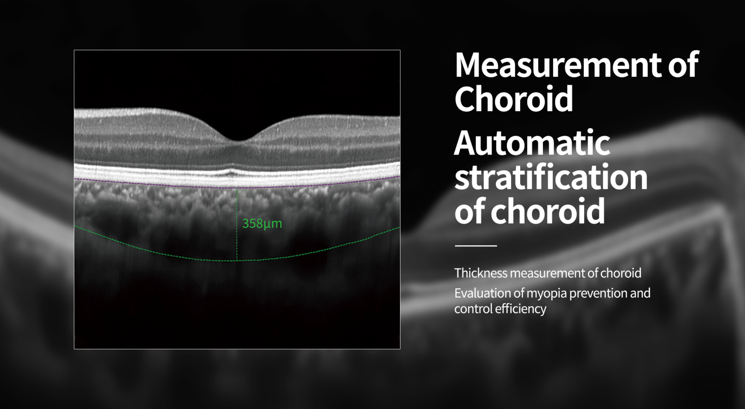 OCT Velite C-800B 86K