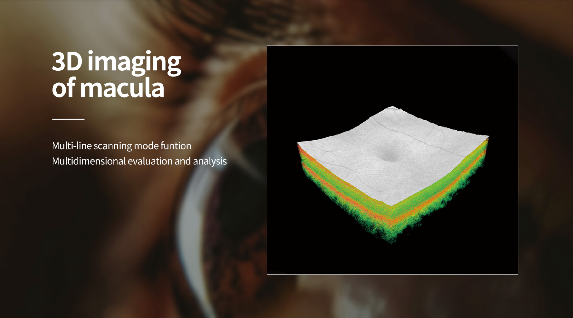 Velite C-800 OCT con Inteligencia Artificial