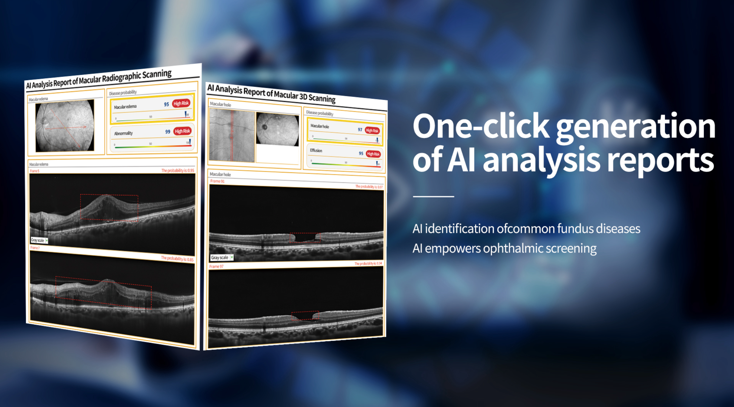 Velite C-800 OCT con Inteligencia Artificial