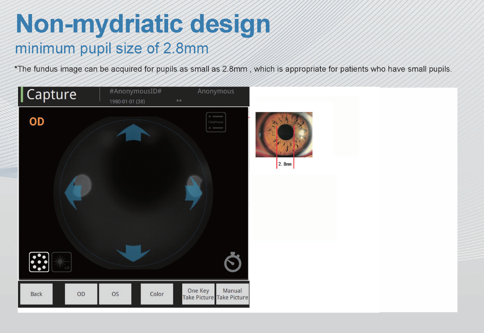 Cámara Retinal No Midriática ALL IN ONE RetiCam-3100 MINI