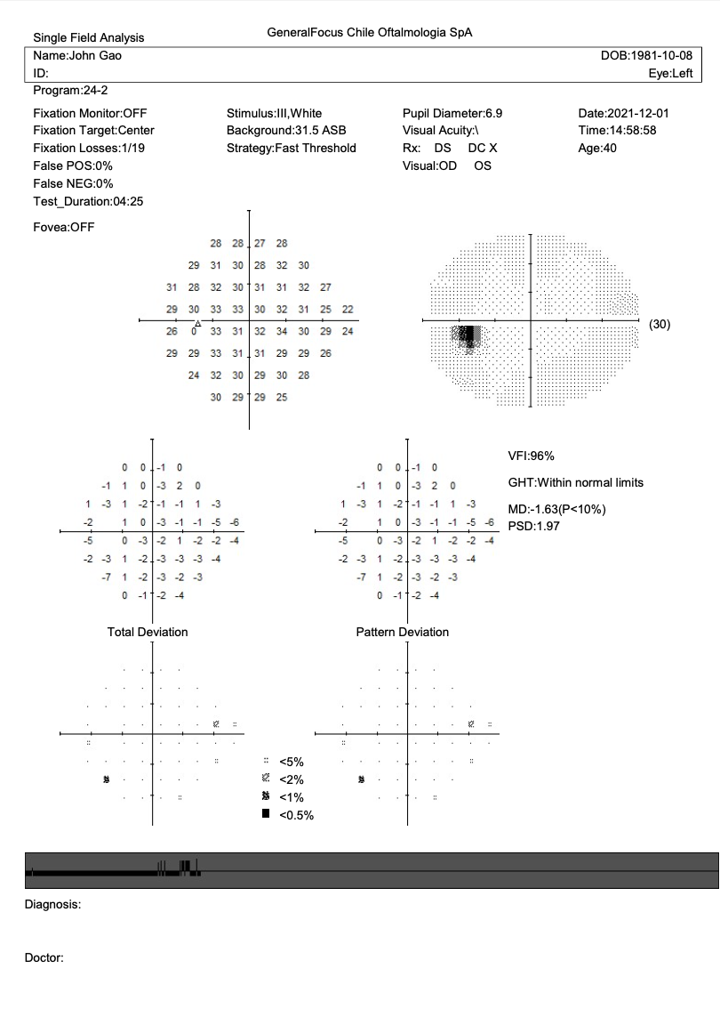 Campímetro de Proyección CVC-1100i / SYSEYE Medical