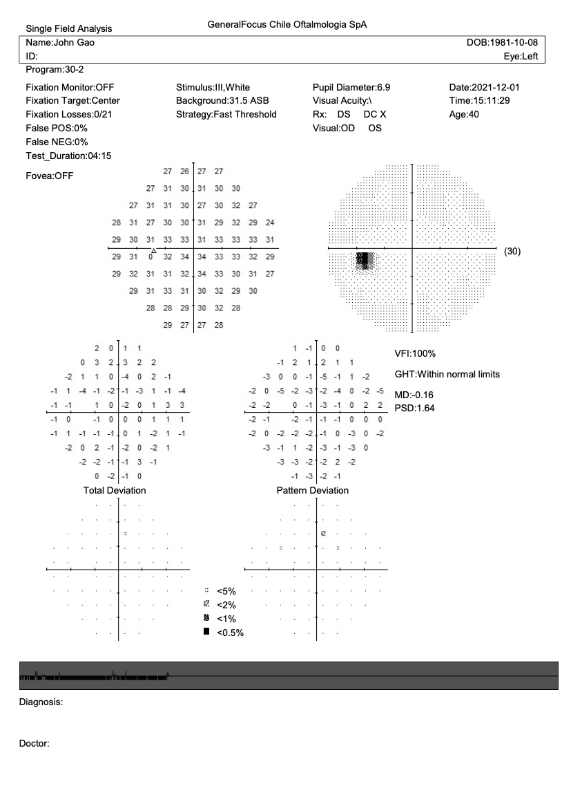 Campímetro de Proyección CVC-1100i / SYSEYE Medical