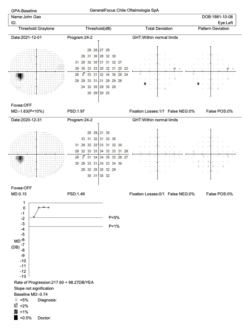 Campímetro de Proyección CVC-1100i / SYSEYE Medical