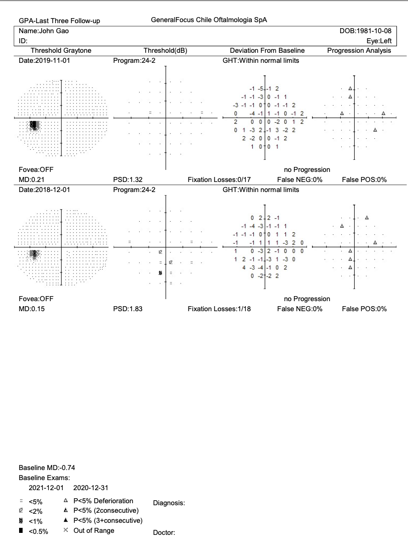 Campímetro de Proyección CVC-1100i / SYSEYE Medical