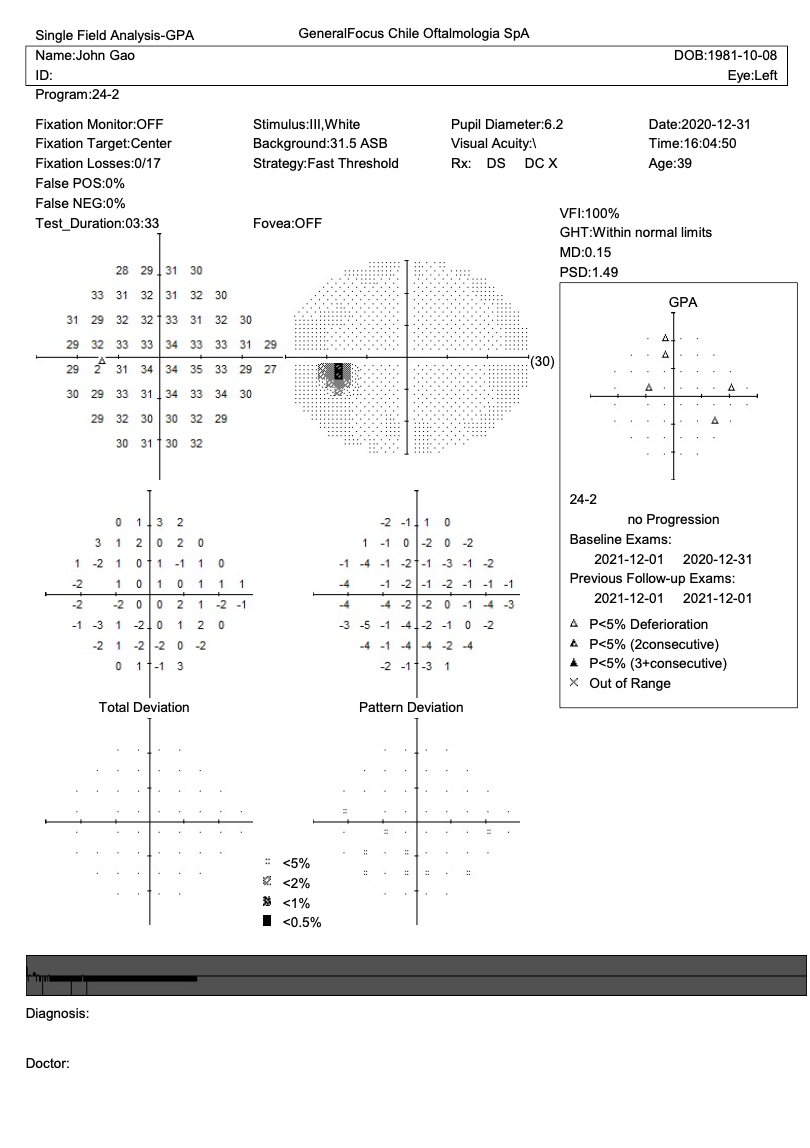 Campímetro de Proyección CVC-1100i / SYSEYE Medical