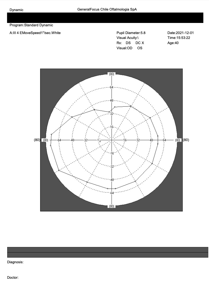 Campímetro de Proyección CVC-1100i / SYSEYE Medical