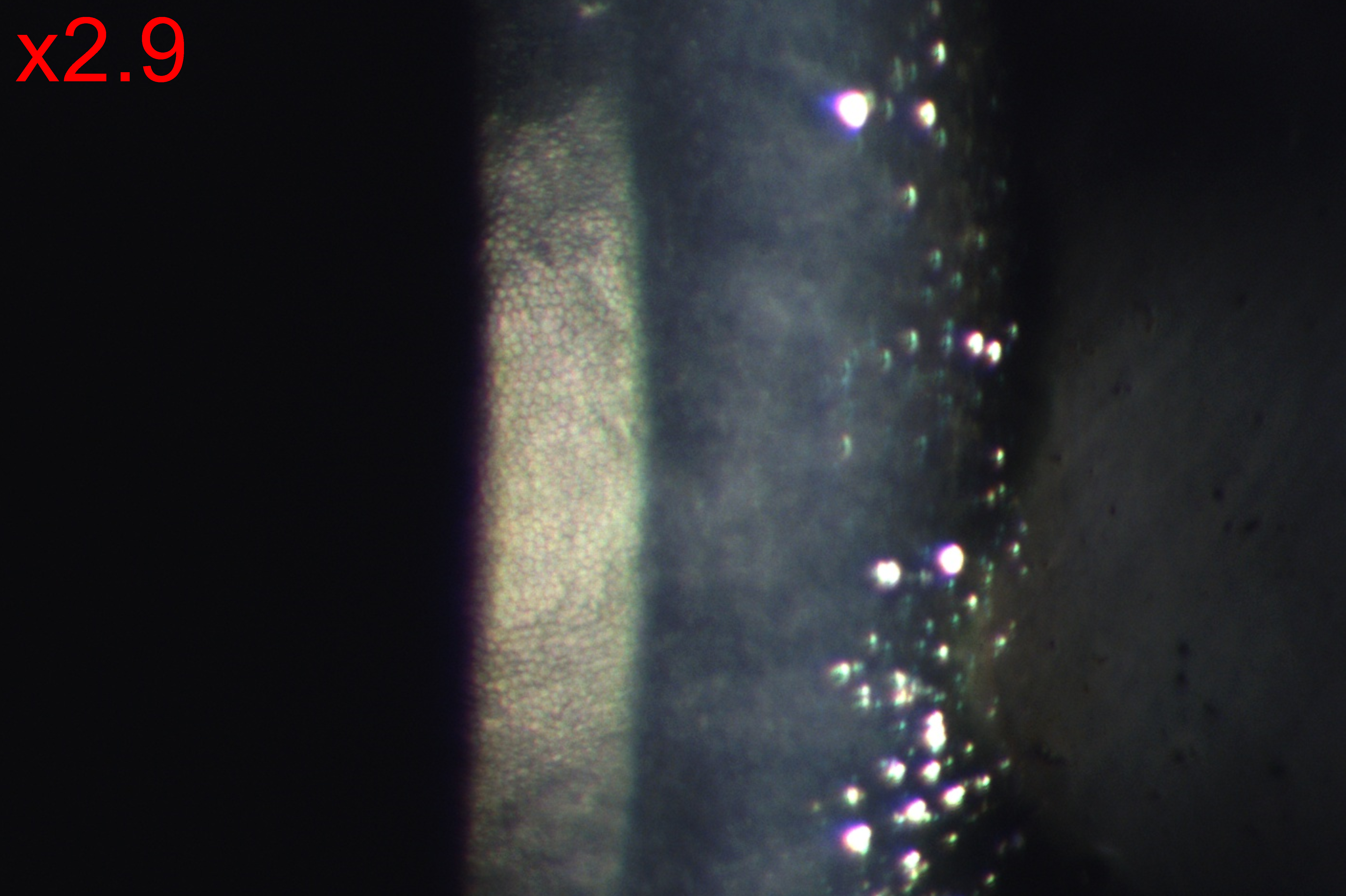 Analizador de Superficie Ocular DA-1