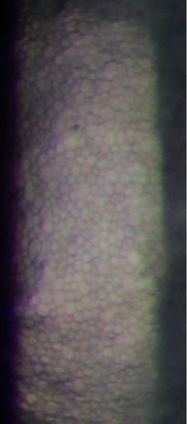 Lámpara de Hendidura Digital LS-5C + Módulo Ojo Seco