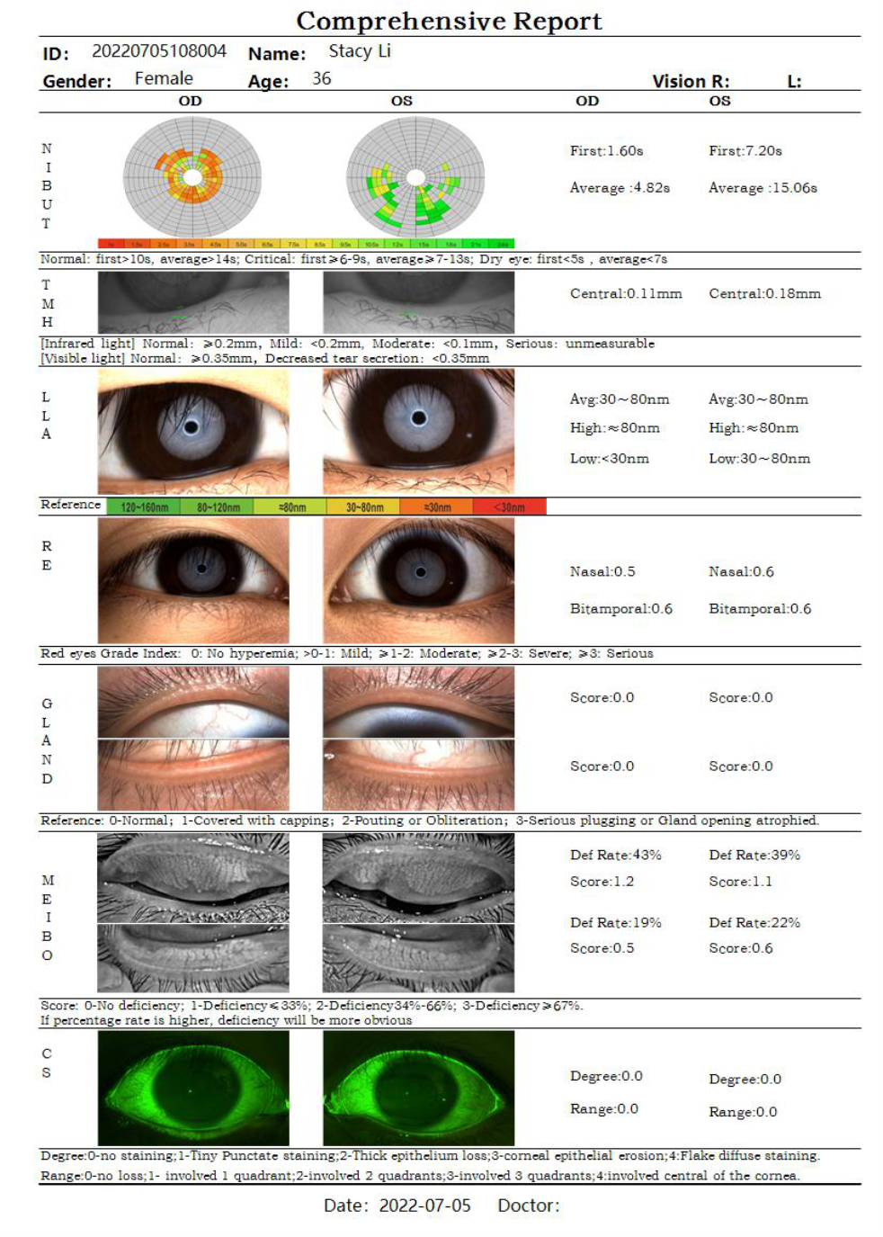Analizador de Superficie Ocular DA-1