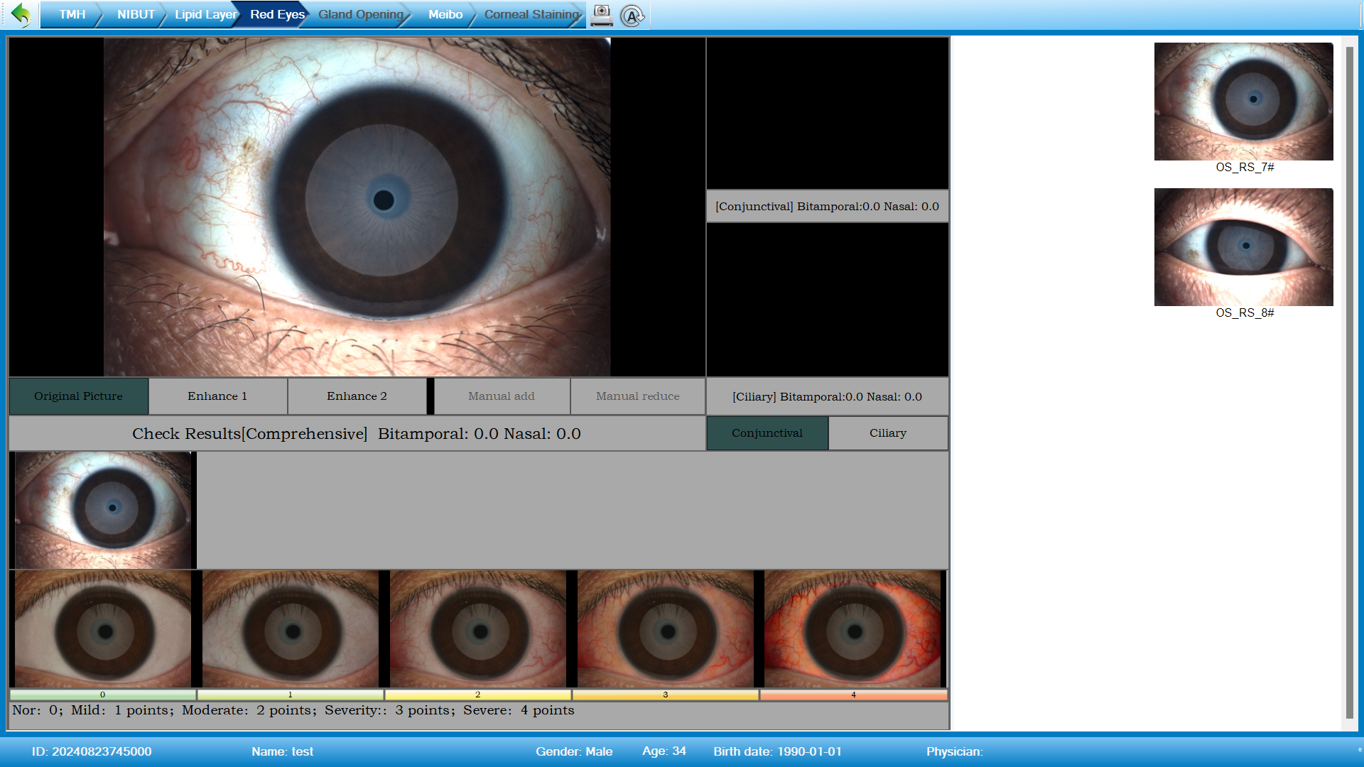 Analizador de Superficie Ocular Portátil DA-2