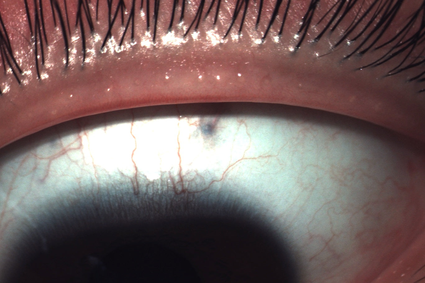 Analizador de Superficie Ocular Avanzado DA-3