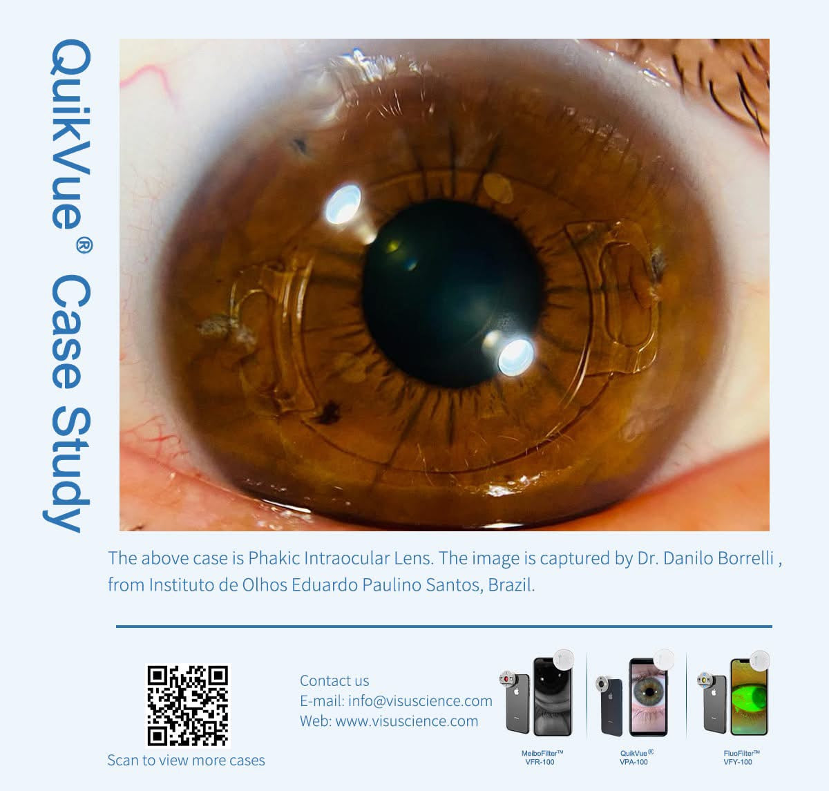 Adaptador de Imagen Ocular QuickVue Plus