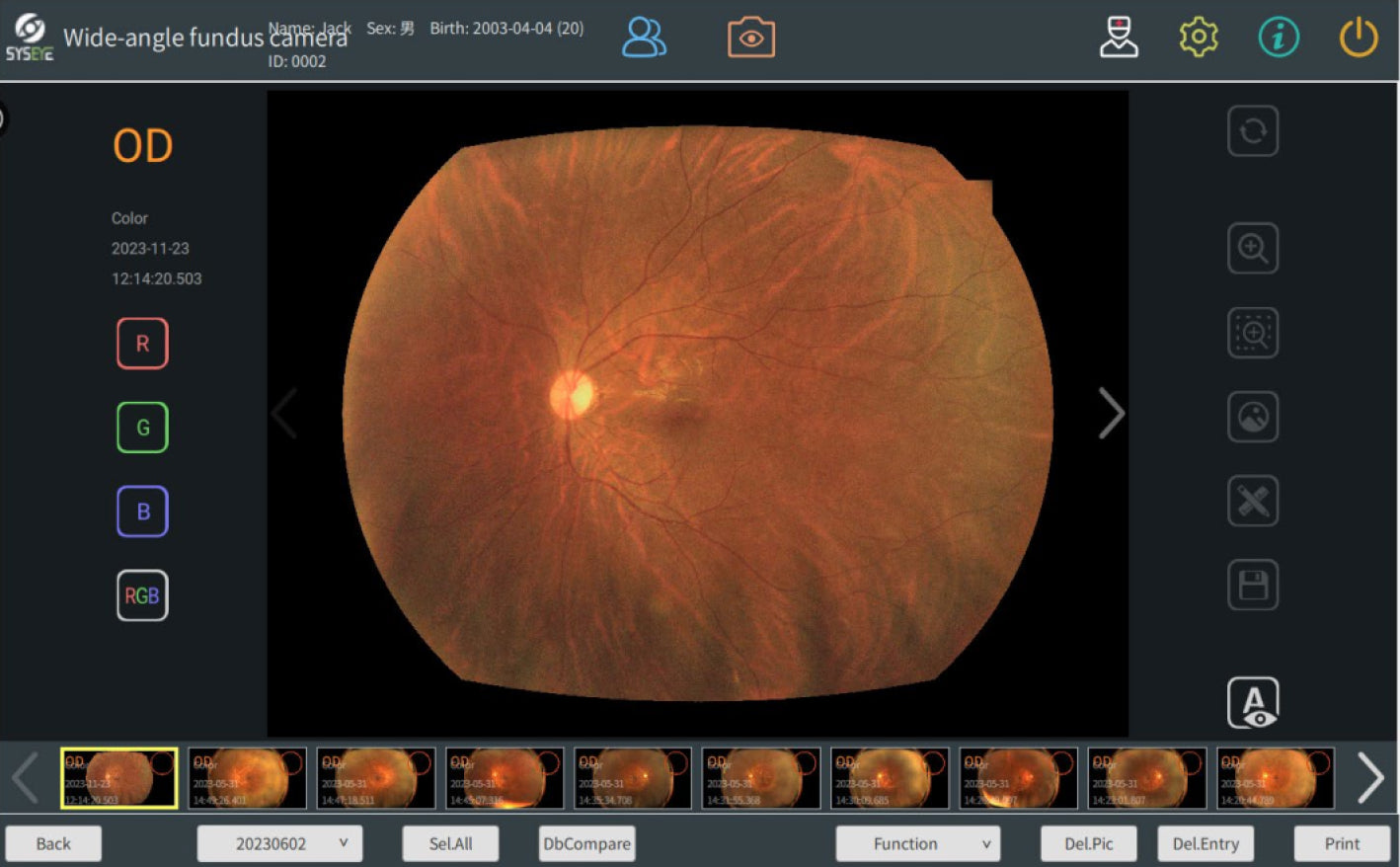 Cámara Retinal Ultra Wide Field RetiCam PLUS