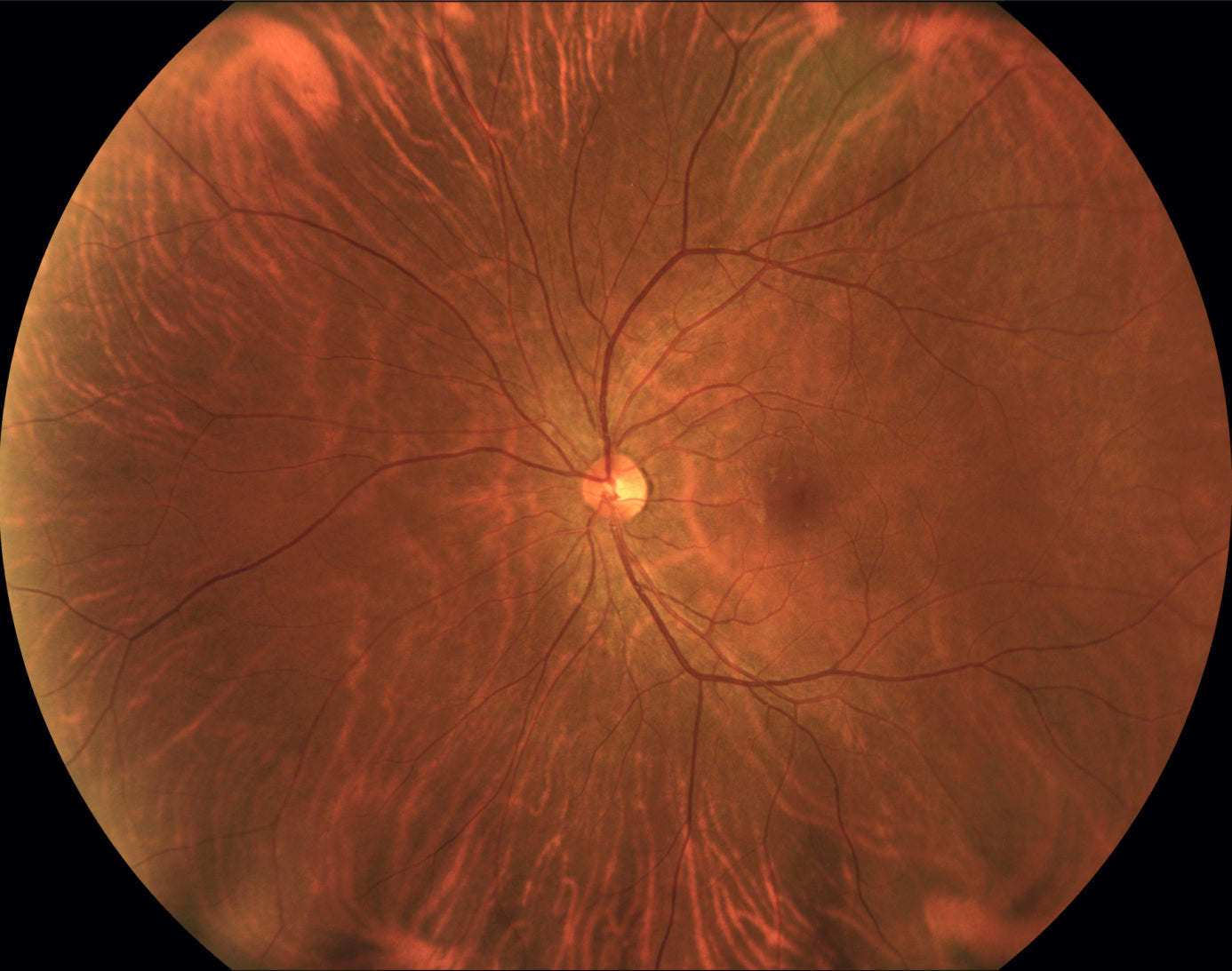 Cámara Retinal Ultra Wide Field RetiCam PLUS