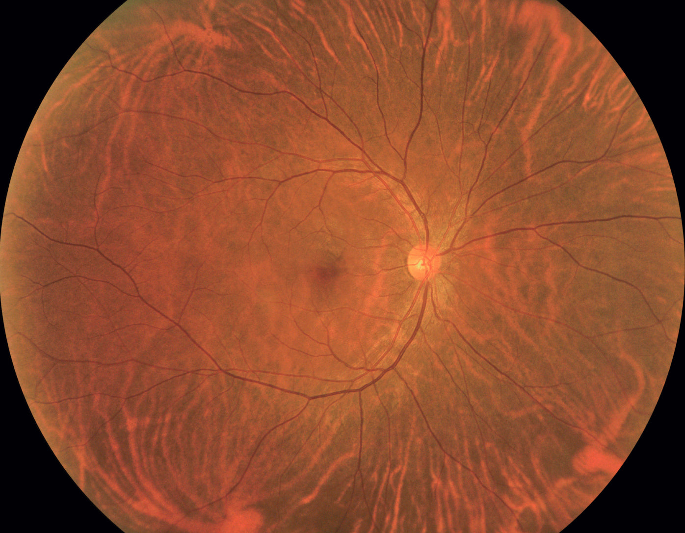 Cámara Retinal Ultra Wide Field RetiCam PLUS