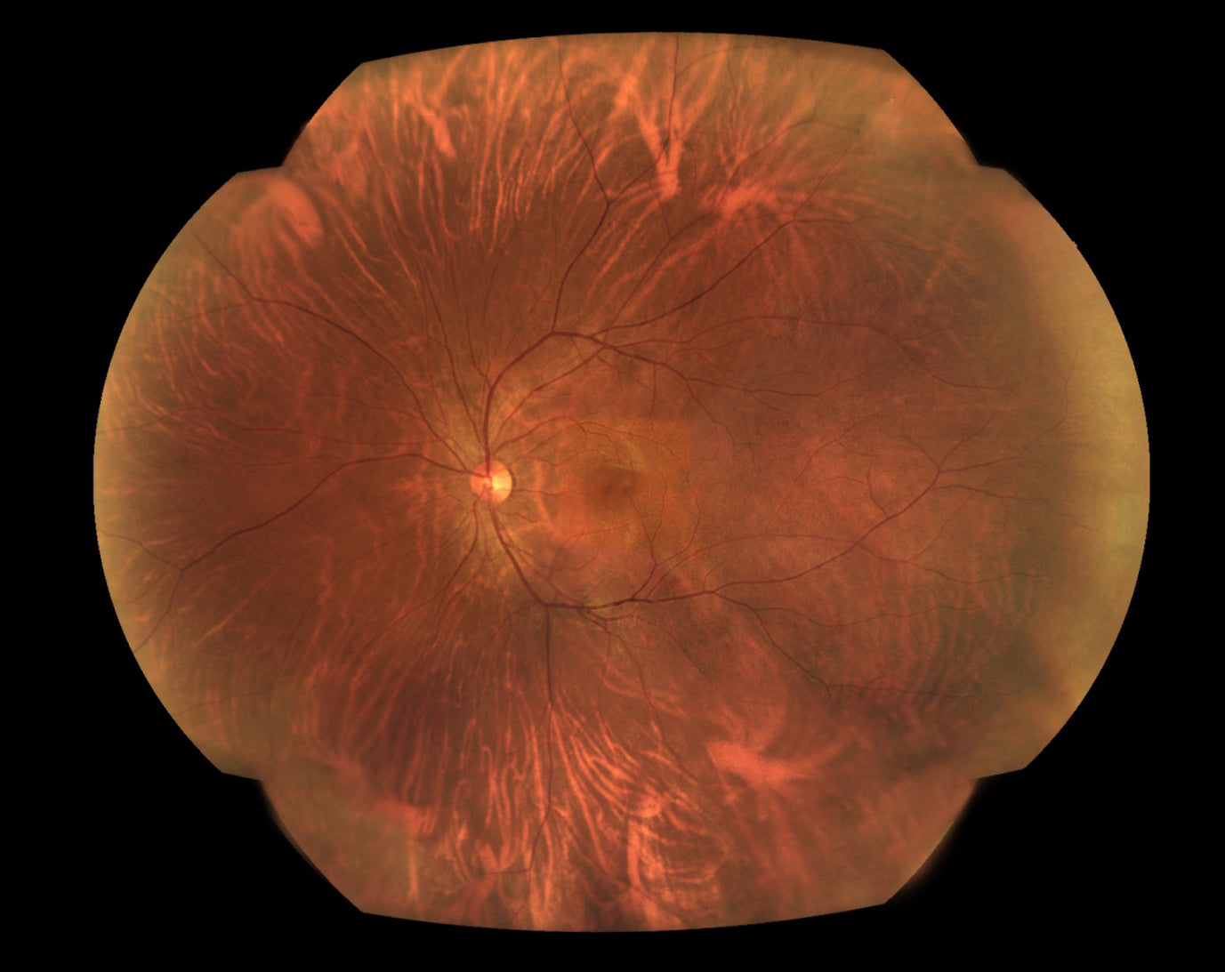 Cámara Retinal Ultra Wide Field RetiCam PLUS