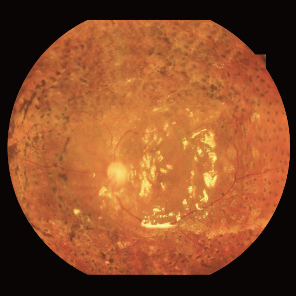 Cámara Retinal Ultra Wide Field RetiCam PLUS