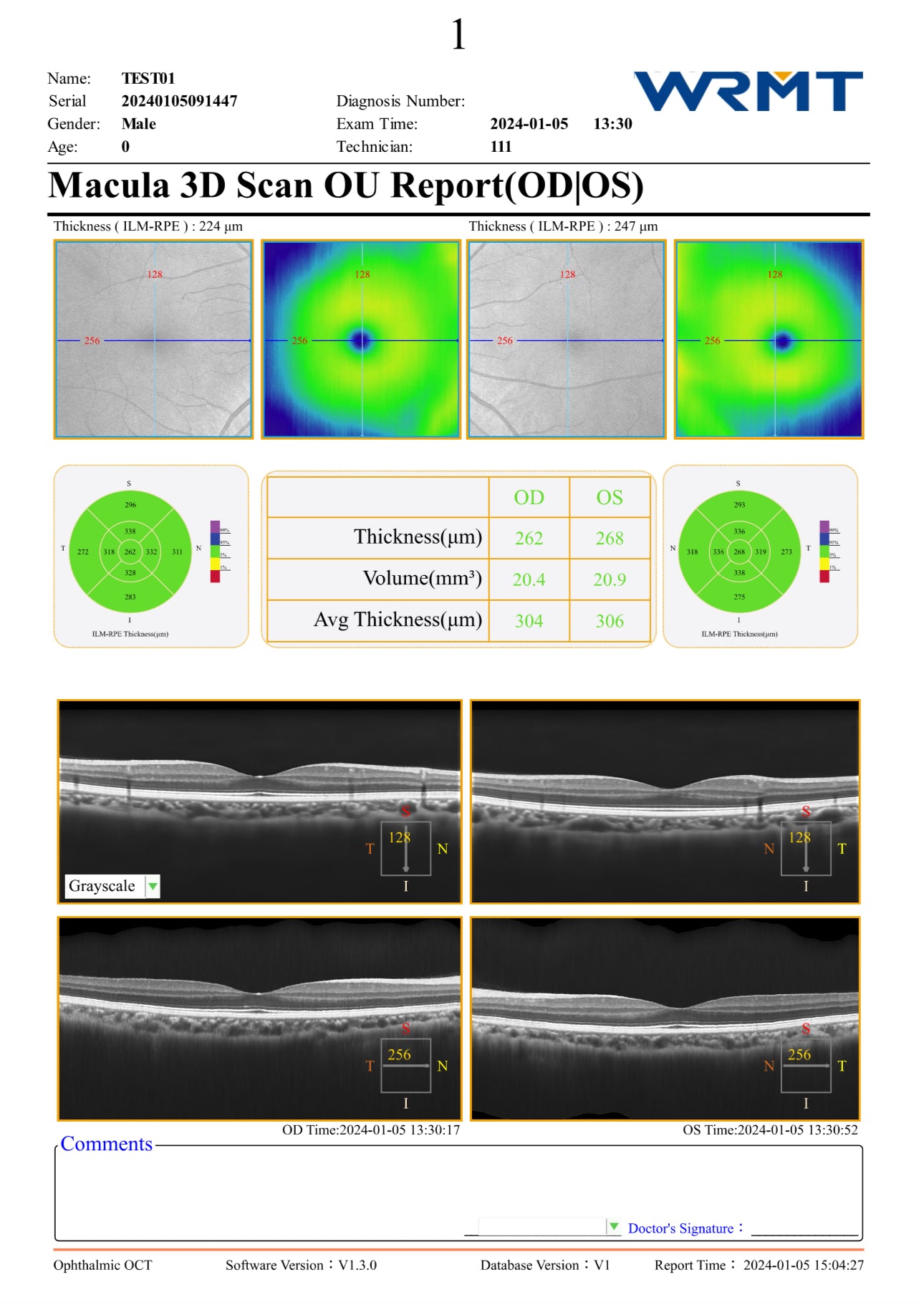 OCT 8K Velite C-2000 A.I.