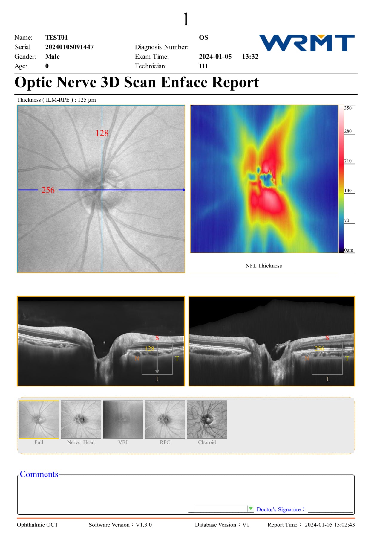 OCT Velite C-3000 OCT-ANGIO Alta Velocidad / Ultra Alta Resolución