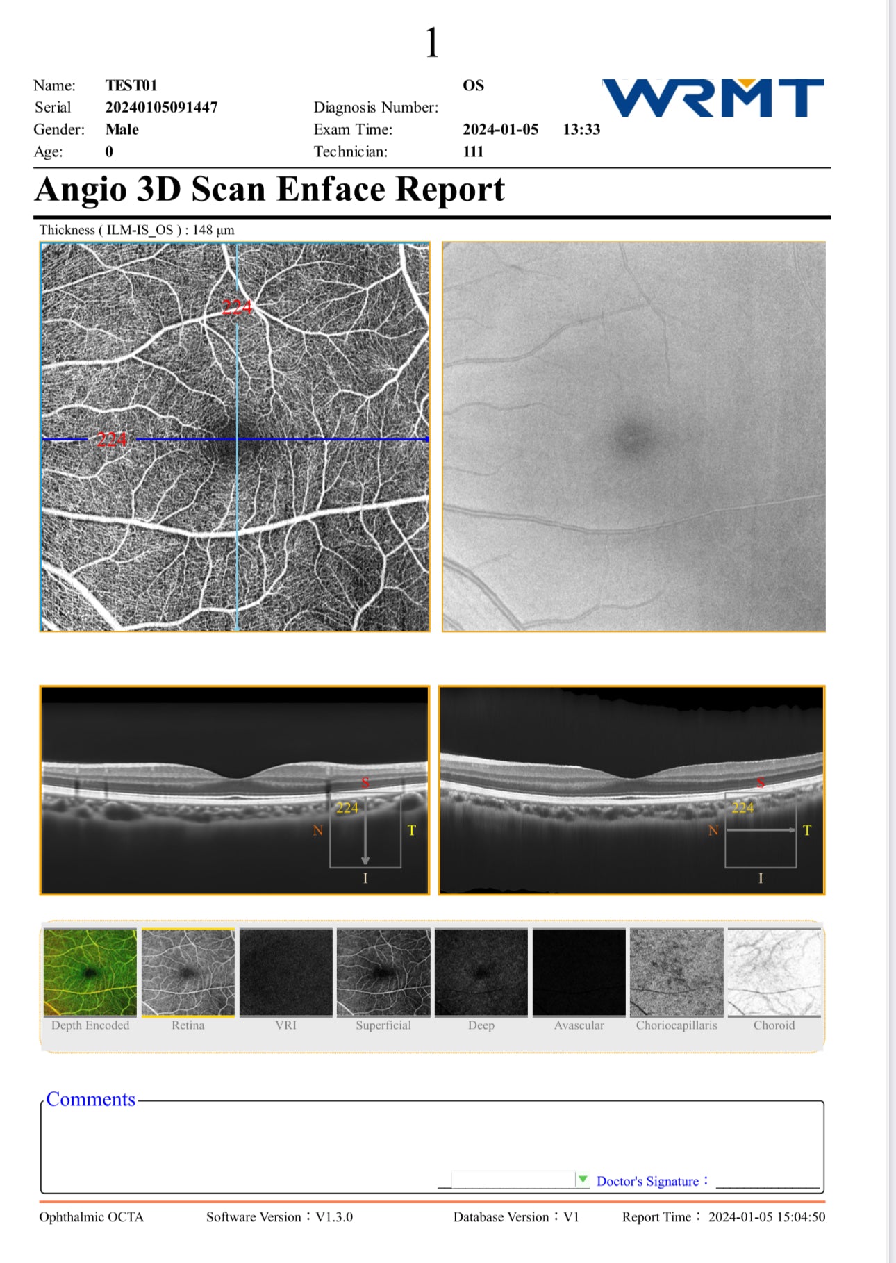 OCT Velite C-3000 OCT-ANGIO Alta Velocidad / Ultra Alta Resolución