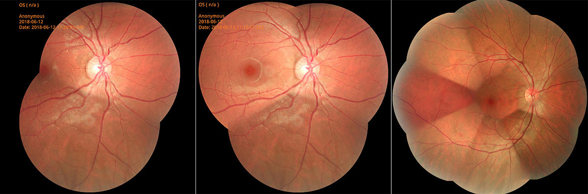 Cámara Retinal No Midriática RetiCam-5100 PRO ALL IN ONE (*Angio/AutoFluor)