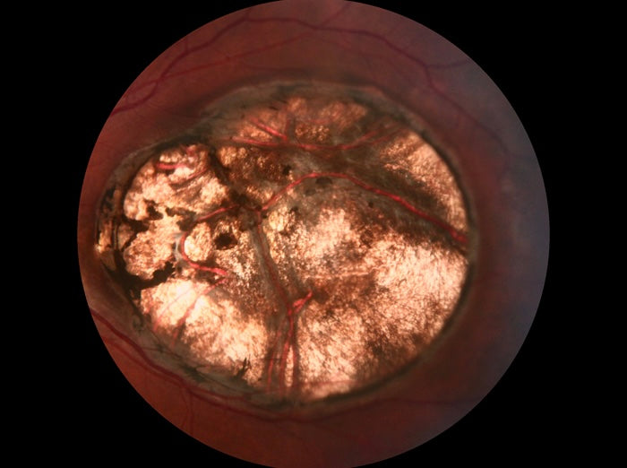 Cámara Retinal No Midriatica SK-680 A