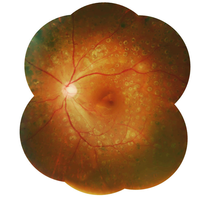 Cámara Retinal No Midriatica SK-680 A