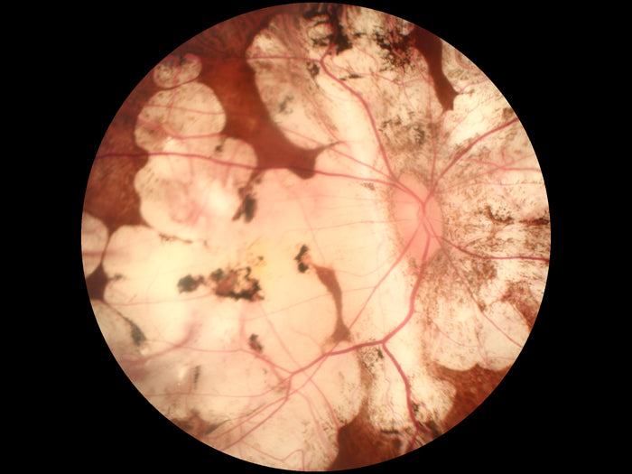 Cámara Retinal No Midriatica SK-680 A