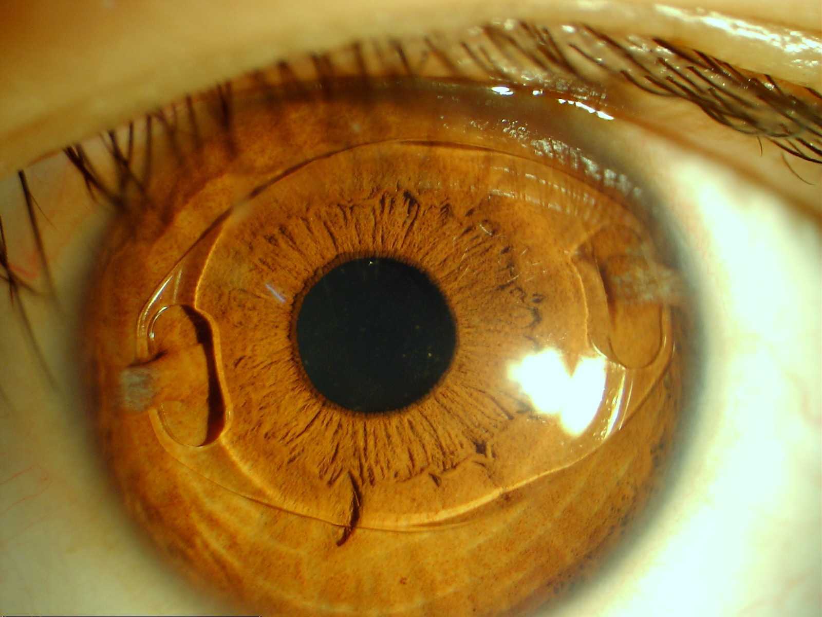 Lámpara de Hendidura Digital LS-5C + Módulo Ojo Seco