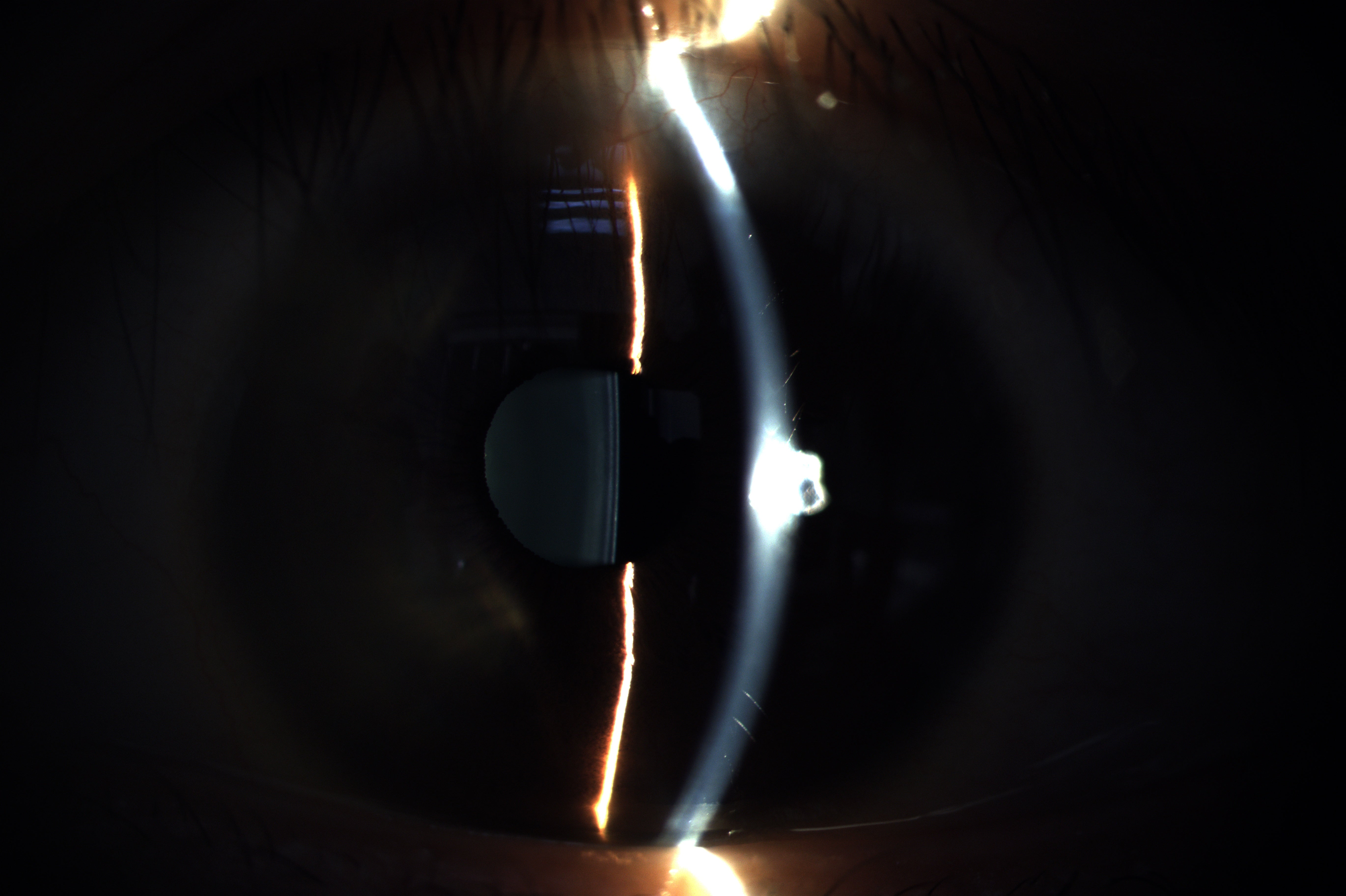 Analizador de Superficie Ocular DA-1