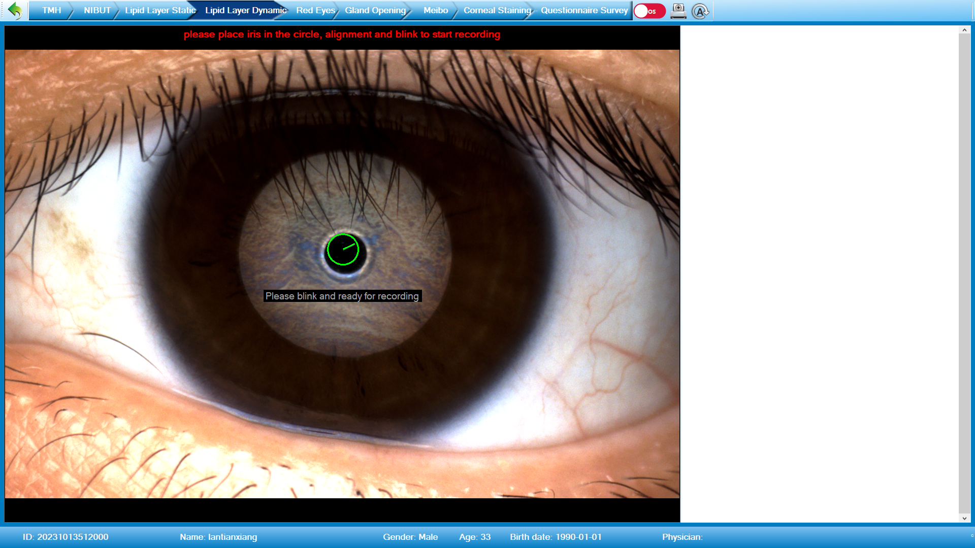 Analizador de Superficie Ocular Avanzado DA-3