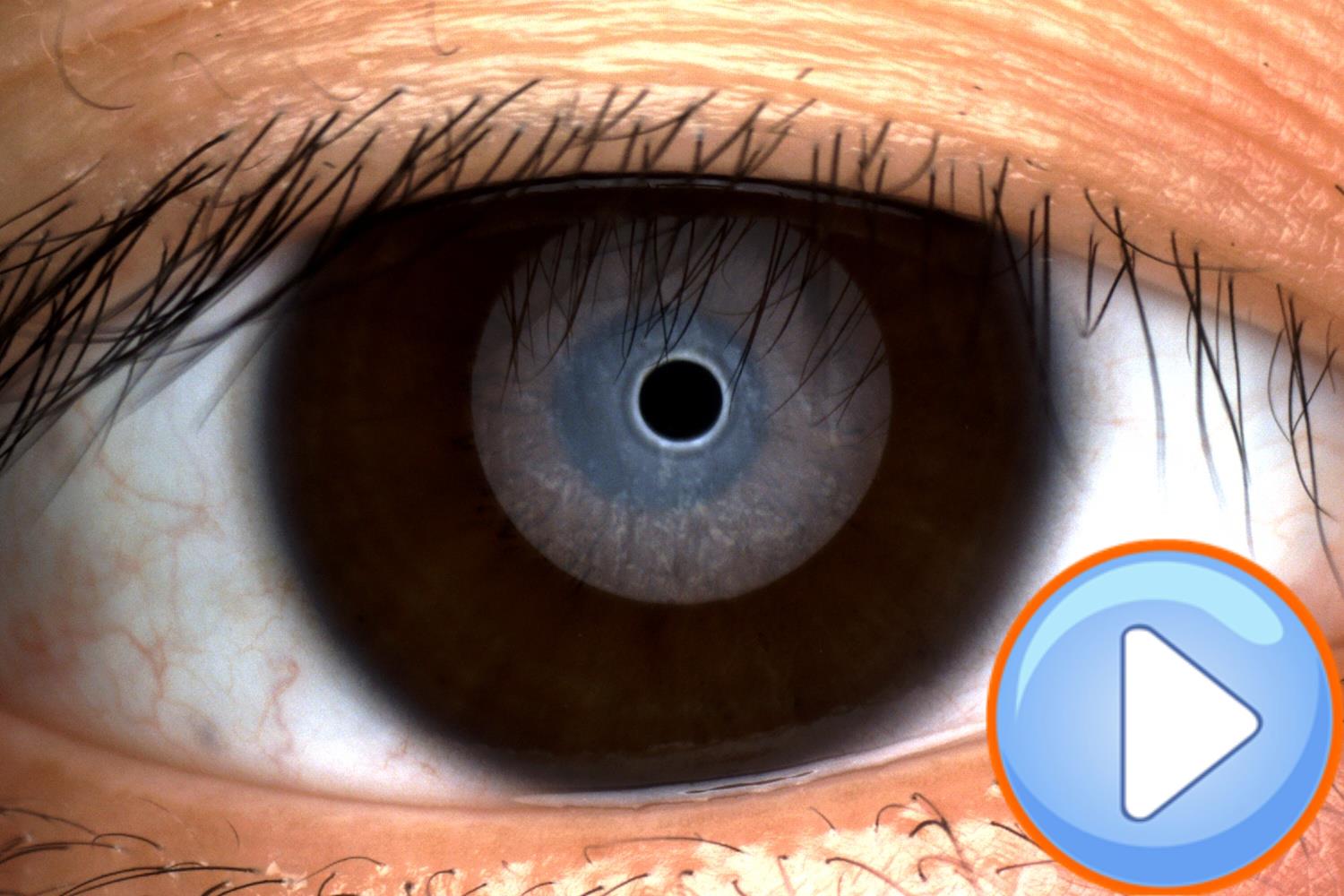 Analizador de Superficie Ocular Avanzado DA-3