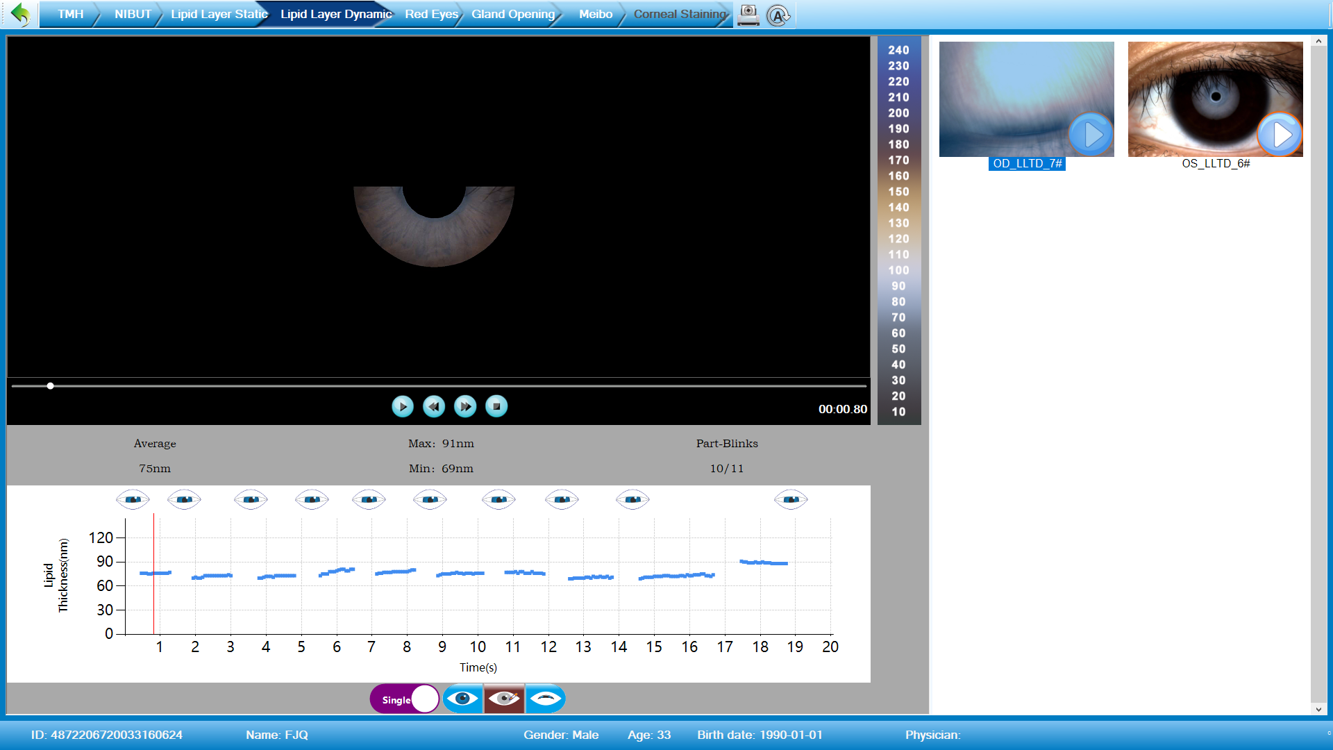Analizador de Superficie Ocular Avanzado DA-3