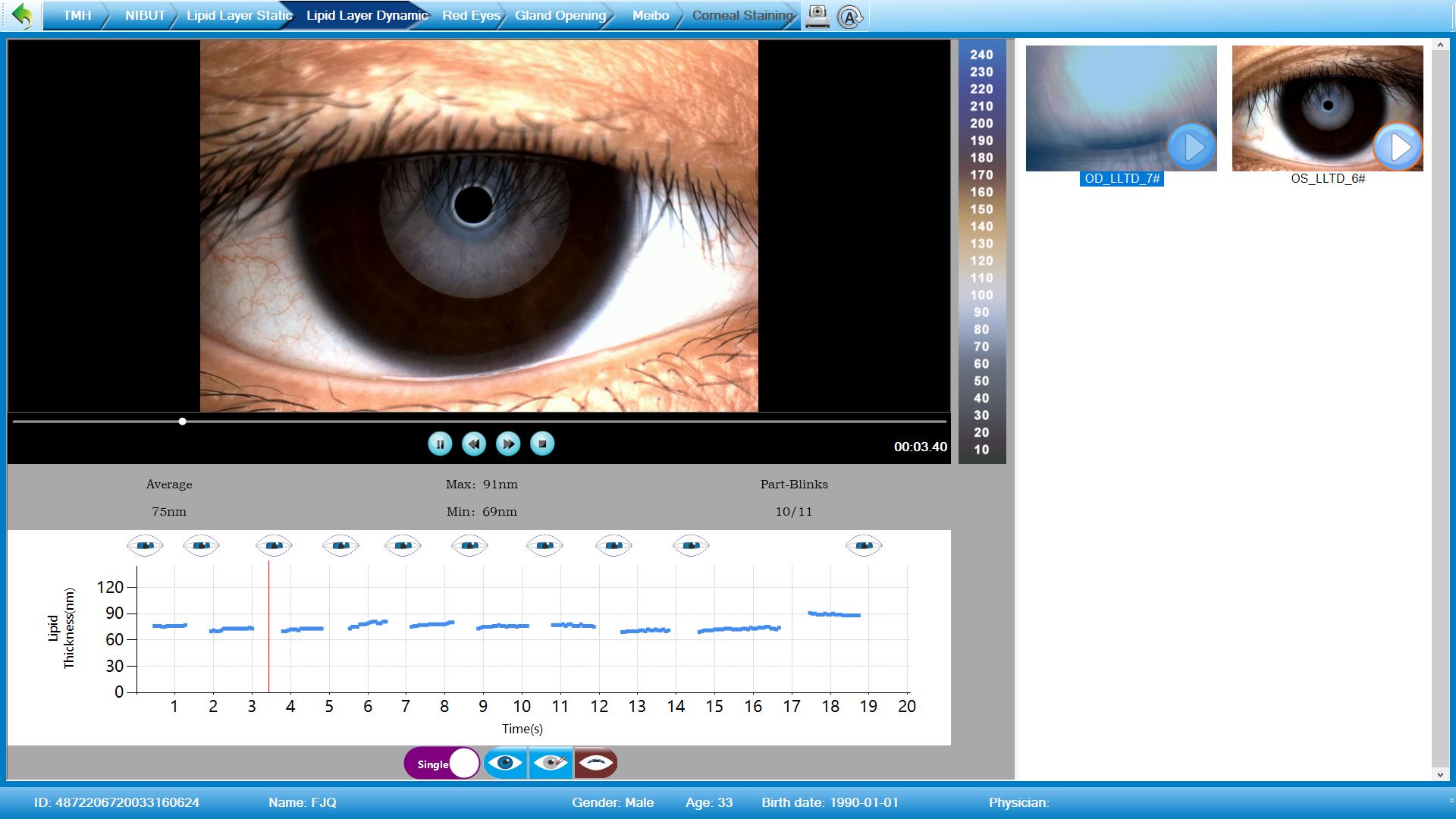 Analizador de Superficie Ocular Avanzado DA-3