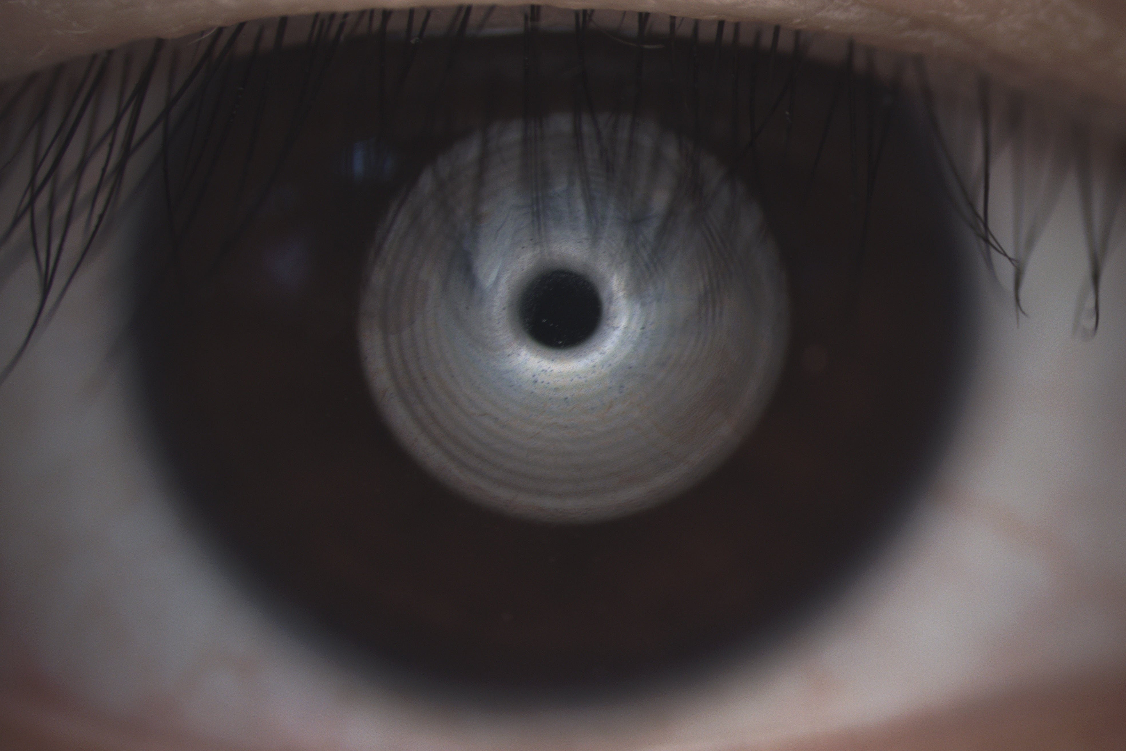 Analizador de Superficie Ocular DA-1