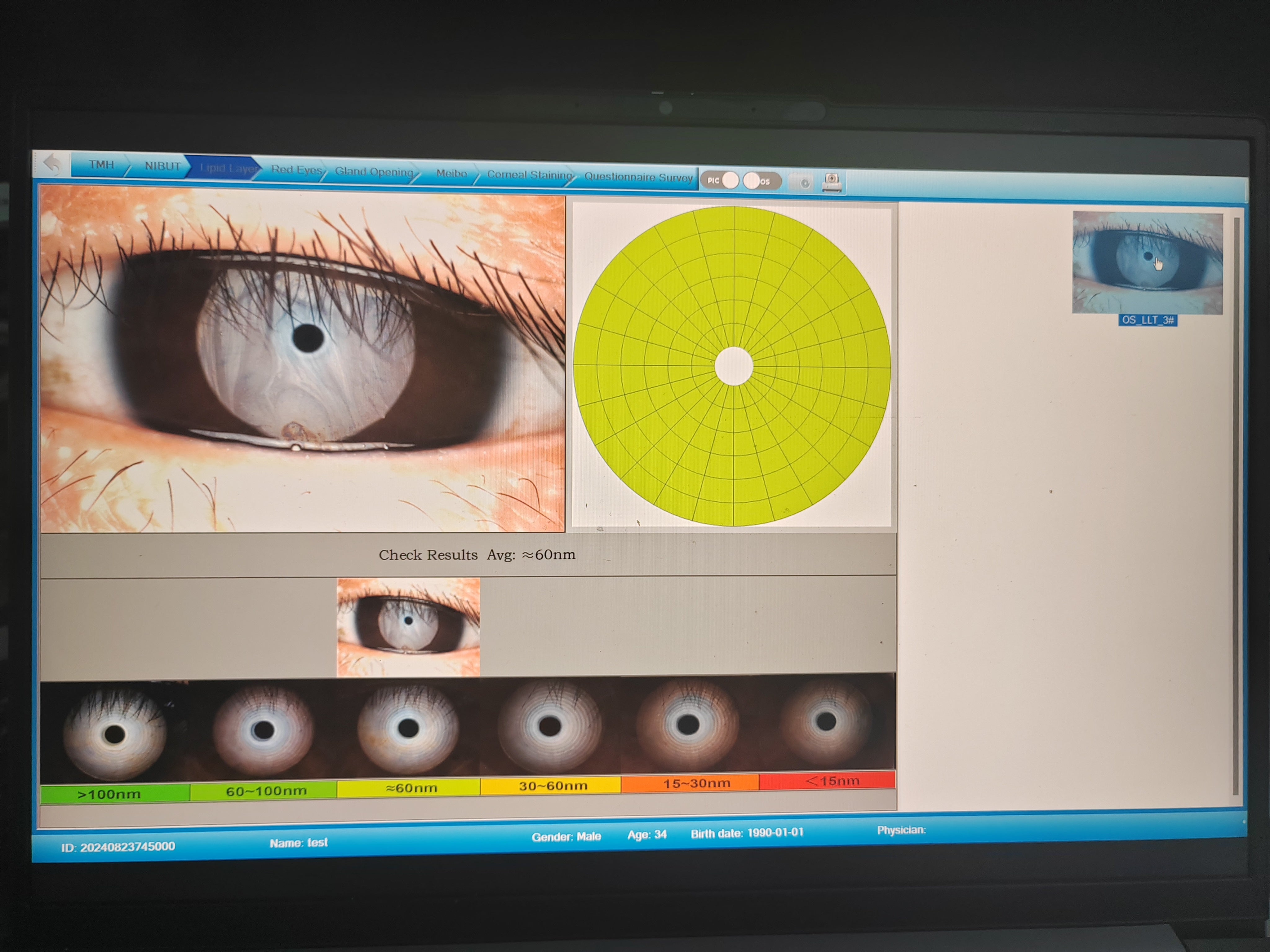 Analizador de Superficie Ocular Portátil DA-2