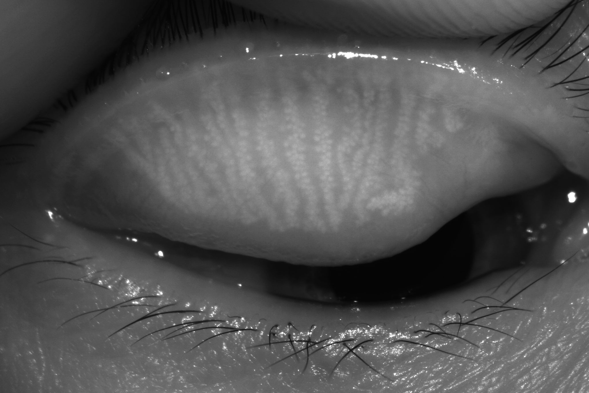 Analizador de Superficie Ocular Avanzado DA-3