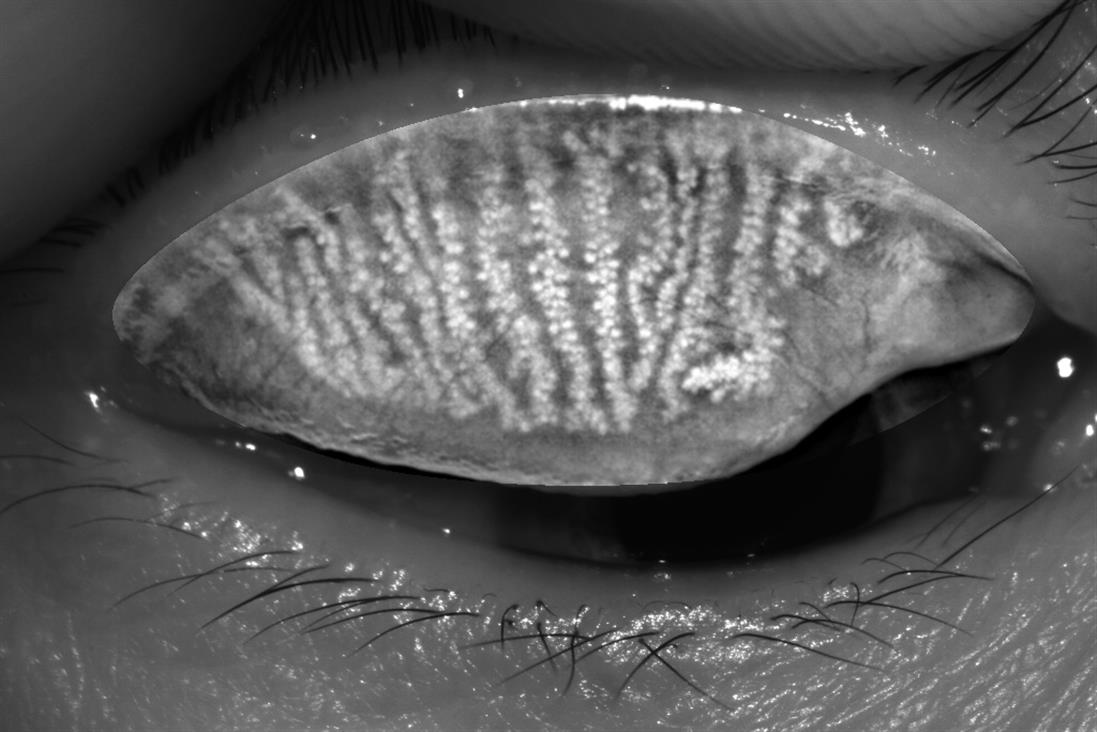 Analizador de Superficie Ocular Avanzado DA-3