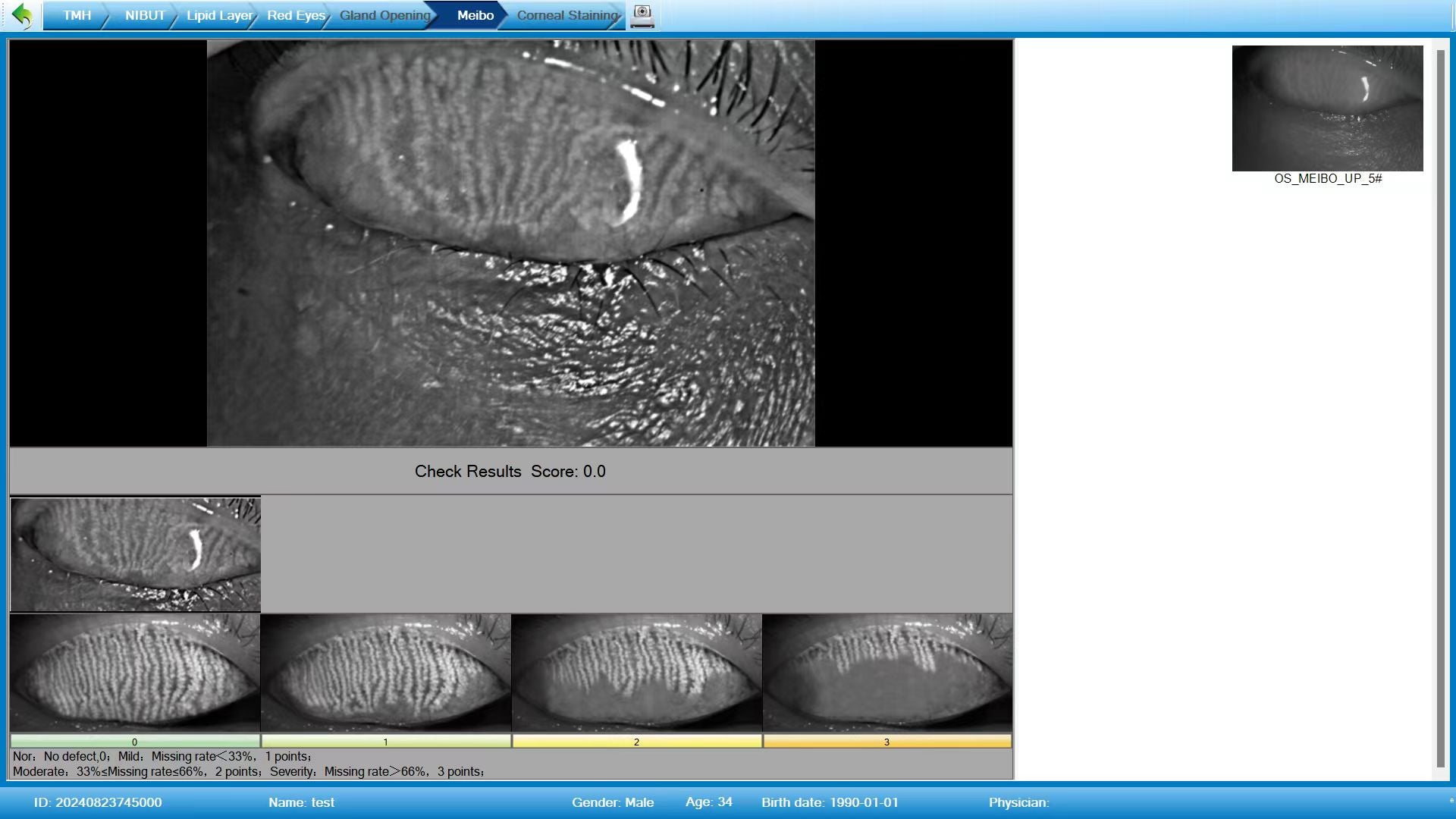 Analizador de Superficie Ocular Portátil DA-2
