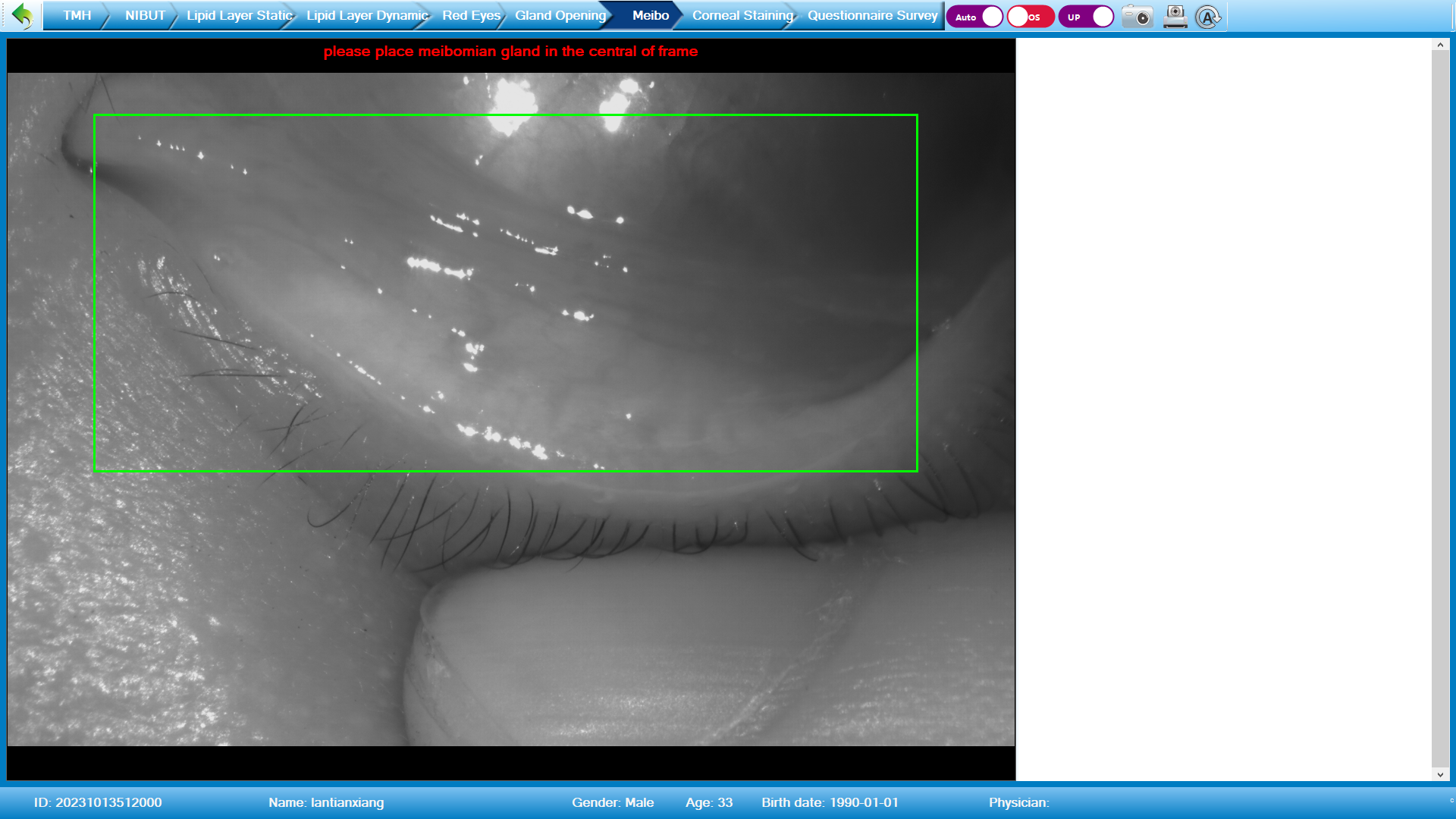 Analizador de Superficie Ocular Avanzado DA-3