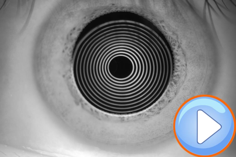 Analizador de Superficie Ocular DA-1