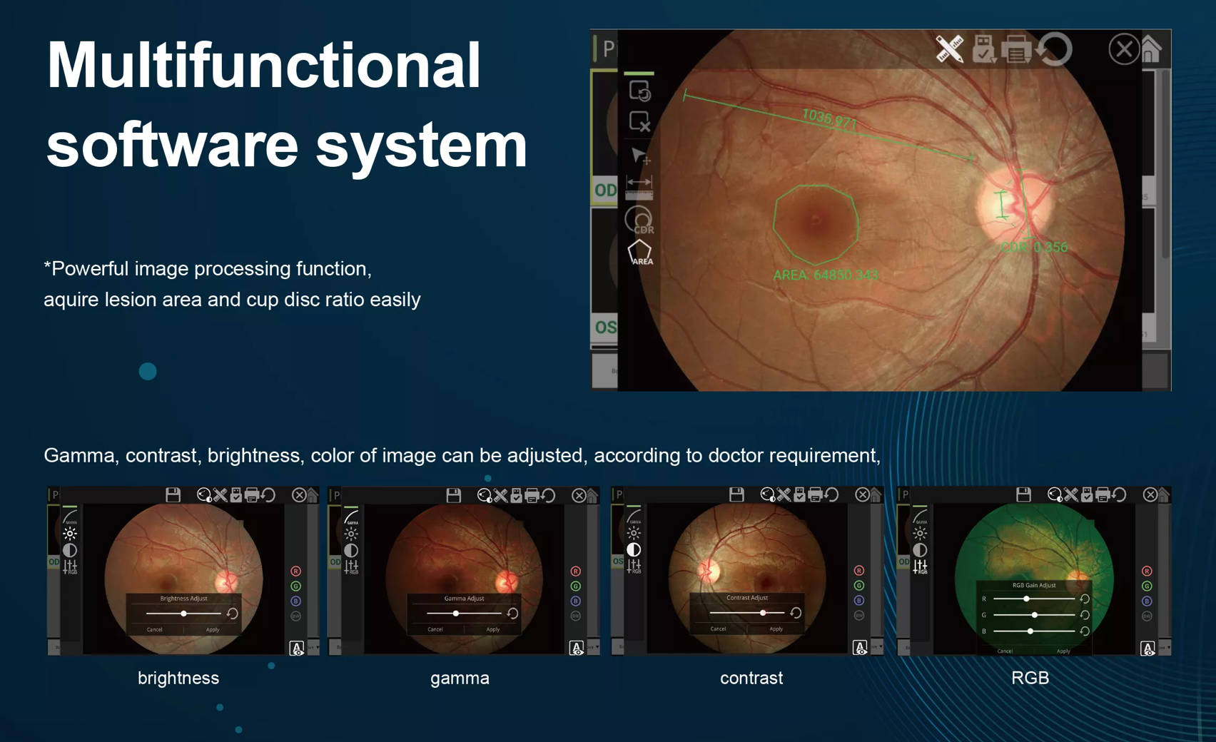 Cámara Retinal No Midriática ALL IN ONE RetiCam-3100 MINI