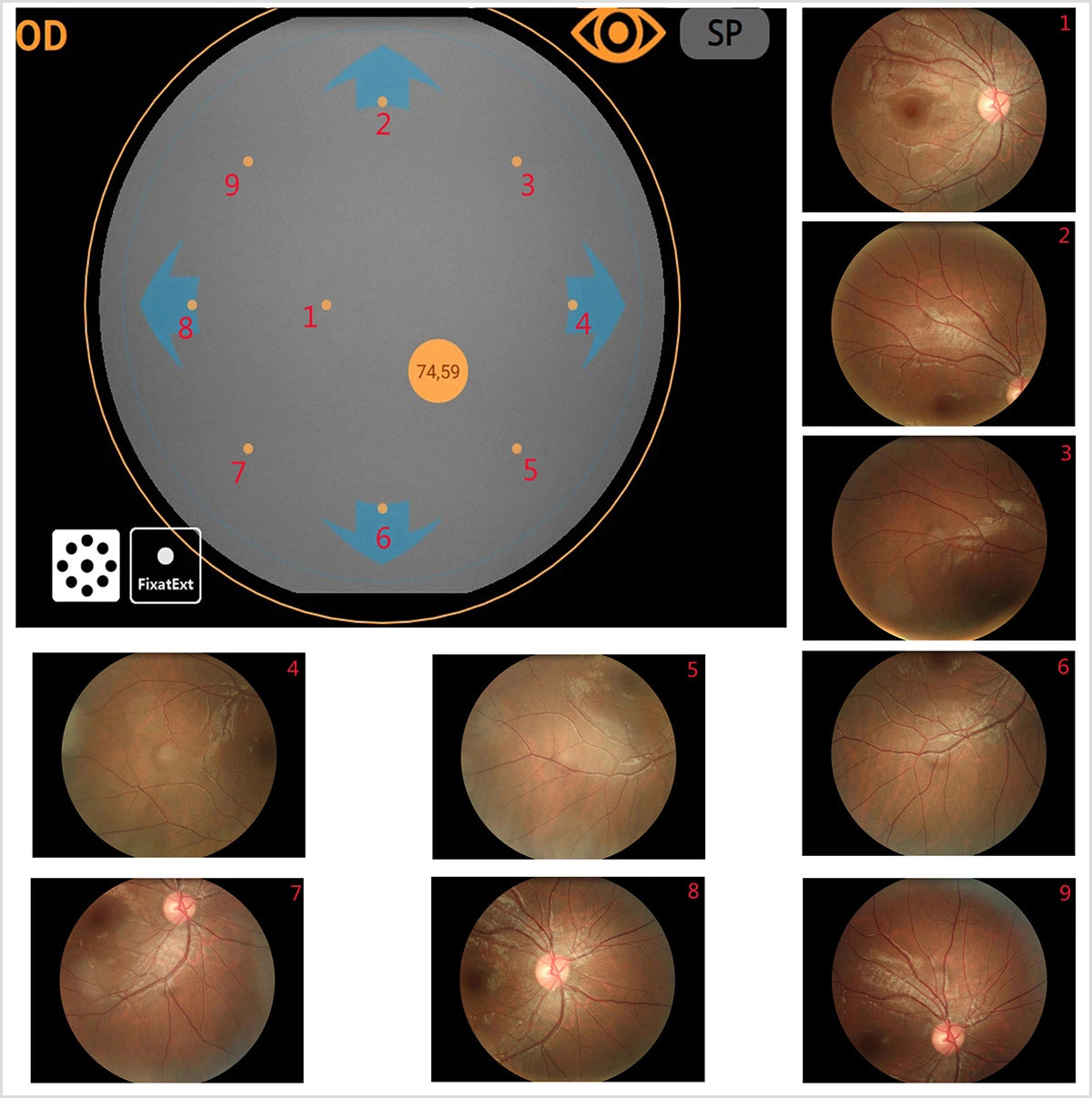 Cámara Retinal No Midriática RetiCam-5100 PRO ALL IN ONE (*Angio/AutoFluor)