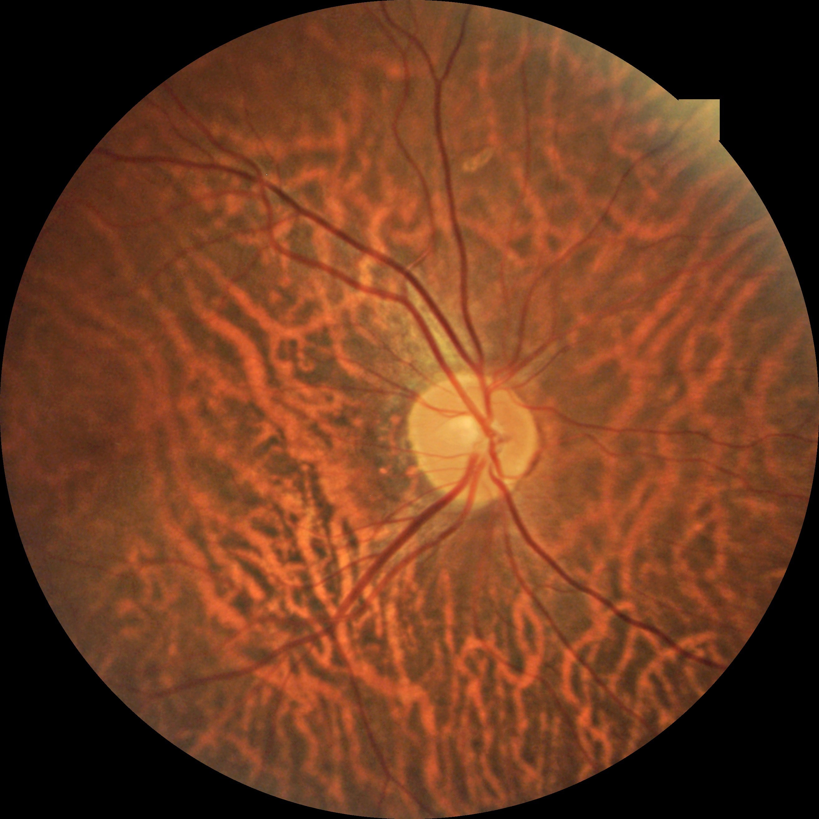 Cámara Retinal No Midriática Portátil Kestrel-300