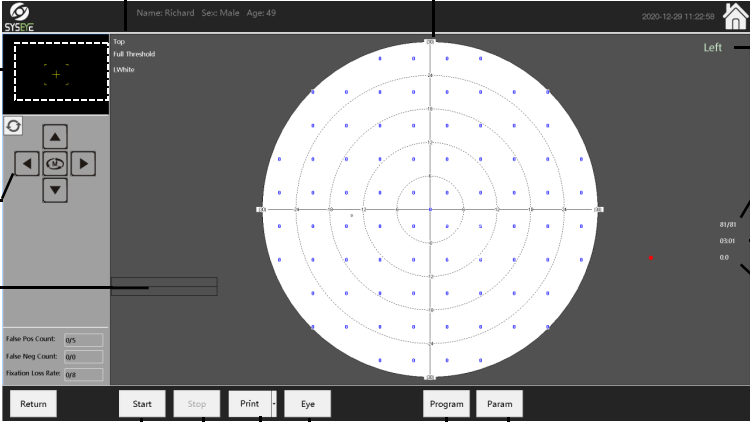Campímetro de Proyección CVC-1100i / SYSEYE Medical