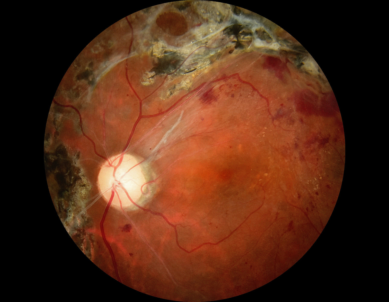 Cámara Retinal No Midriática + Angiográfo SK-650B