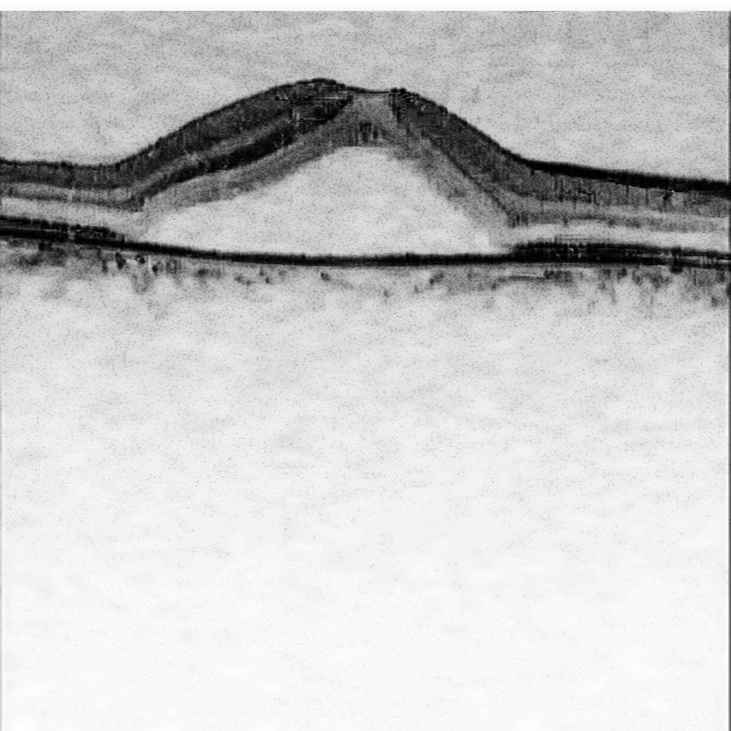 OCT Portátil IXANNER 7vn