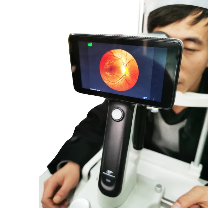 Cámara Retinal Portátil CFC-X / Mocular Medical